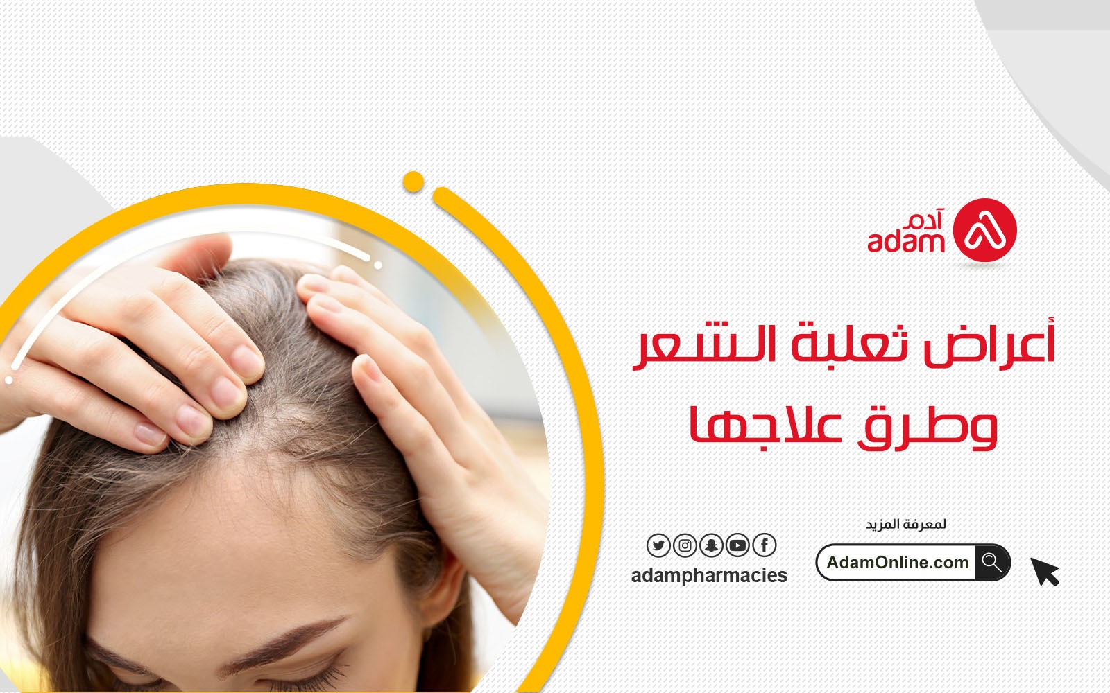 أعراض ثعلبة الشعر وطرق علاجها